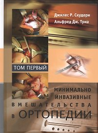 Минимально инвазивные вмешательства в ортопедии: в 2-х томах. Том 1
