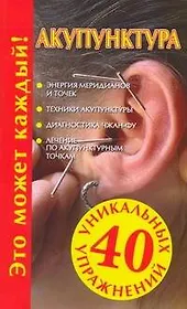 Акупунктура