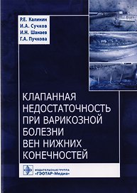 Клапанная недостаточность при варикозной болезни вен нижних конечностей