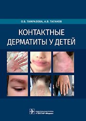 Контактные дерматиты у детей