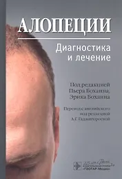 Алопеции. Диагностика и лечение