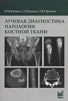 Лучевая диагностика патологии костной ткани