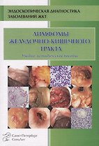 Лимфомы ЖКТ