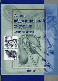 Атлас абдоминальной хирургии. Том 2. Хирургия желудка и двенадцатиперстной кишки