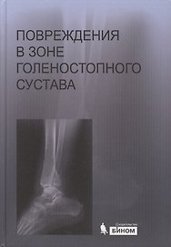 Повреждения в зоне голеностопного сустава : атлас / под ред. академика РАН и РАМН С.П. Миронова.