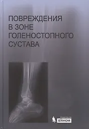 Повреждения в зоне голеностопного сустава : атлас / под ред. академика РАН и РАМН С.П. Миронова.