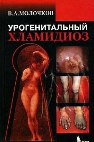 

Урогенитальный хламидиоз