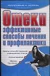 ЗиЖ.Отеки