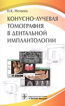 Конусно-лучевая томография в дентальной имплантологии