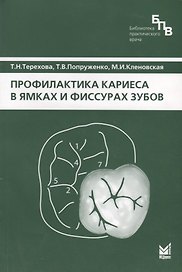 Профилактика кариеса в ямках и фиссурах зубов