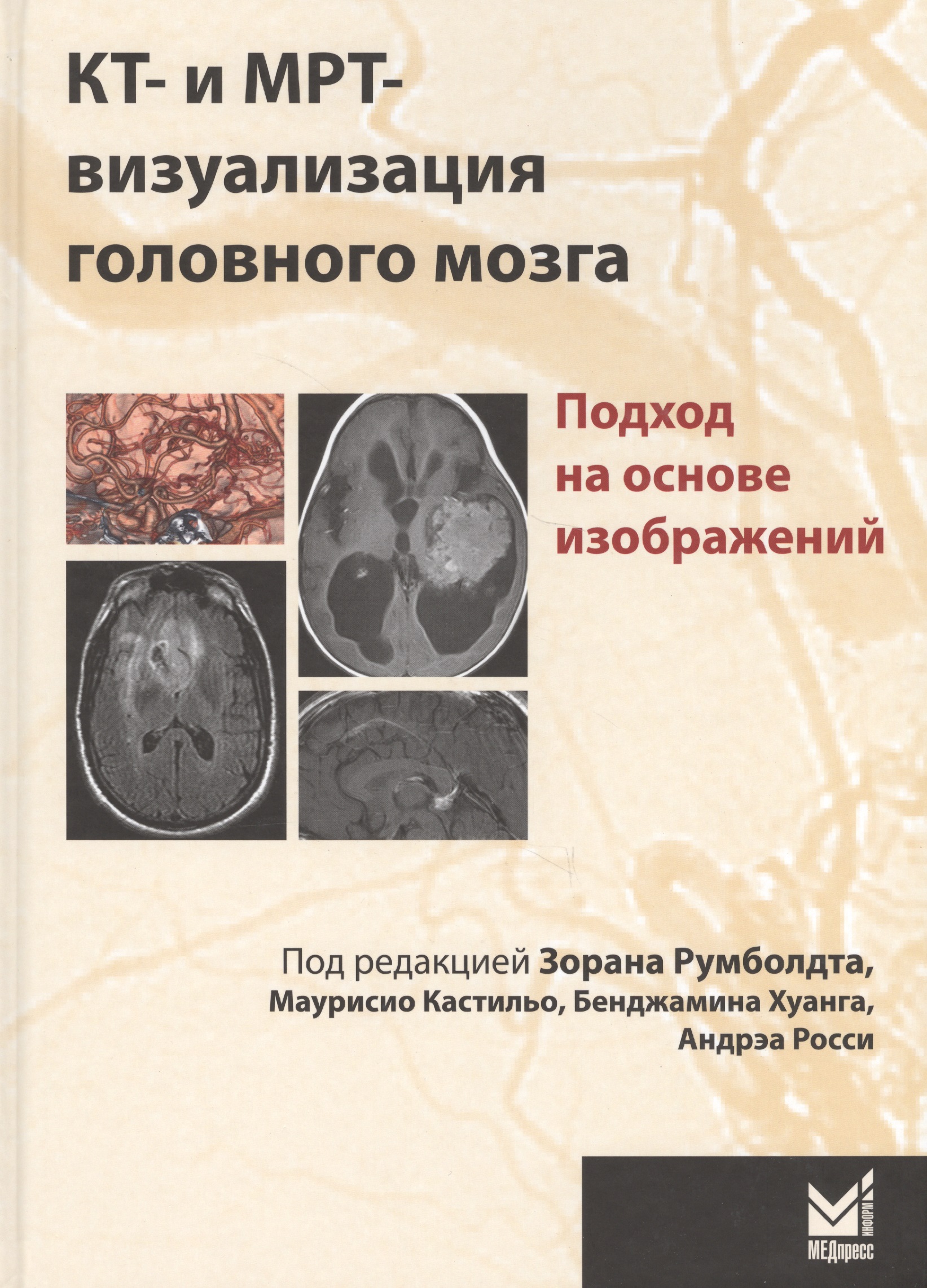Обложка книги «КТ-и МРТ-визуализация головного мозга.подход на основе»