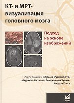 КТ-и МРТ-визуализация головного мозга.подход на основе