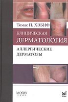 Клиническая дерматология. Аллергические дерматозы.