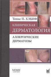 Клиническая дерматология. Аллергические дерматозы.