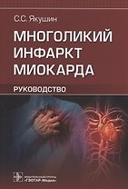 Многоликий инфаркт миокарда: руководство