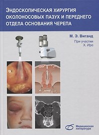 Эндоскопическая хирургия околоносовых пазух и переднего отдела основания черепа