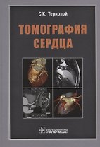 Томография сердца