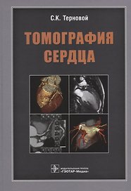 Томография сердца