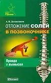 Отложение солей в позвоночнике: Правда и вымысел
