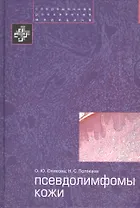 Псевдолимфомы кожи