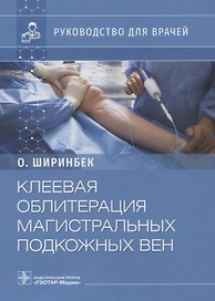 Клеевая облитерация магистральных подкожных вен: руководство для врачей