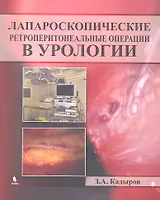 Лапароскопические ретроперитонеальные операции в урологии