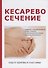 Кесарево сечение - 0