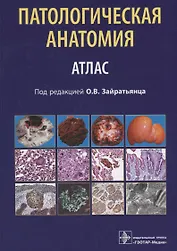 Патологическая анатомия Атлас (Зайратьянц)