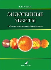Эндогенные увеиты