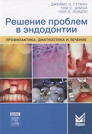 Решение проблем в эндодонтии