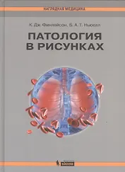 Патология в рисунках