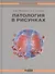 Патология в рисунках - 0