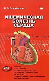 Ишемическая болезнь сердца (мягк). Самойленко В. (Миклош)
