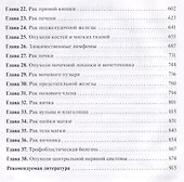 Онкология. Учебник - 2