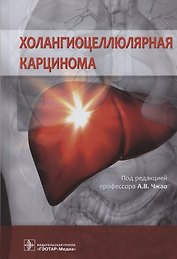 Холангиоцеллюлярная карцинома
