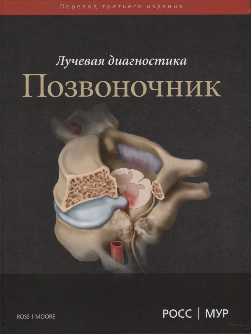 

Лучевая диагностика. Позвоночник