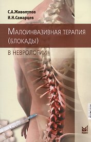 Малоинвазивная терапия (блокады) в неврологии