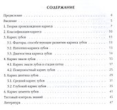 Кариес зубов - 1