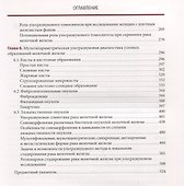 Ультразвуковое исследование молочных желез - 2