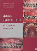 Мини-имплантаты. Ортодонтия будущего.