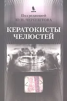 Кератокисты челюстей.