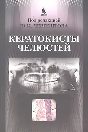 Кератокисты челюстей.