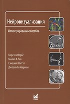 Нейровизуализация