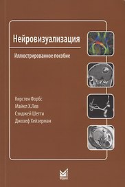 Нейровизуализация