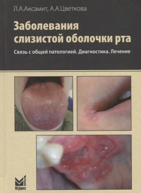 

Заболевания слизистой оболочки рта. Связь с общей патологией. Диагностика. Лечение. 2-е изд.