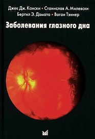Заболевания глазного дна