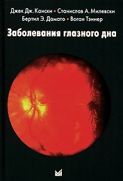 Заболевания глазного дна