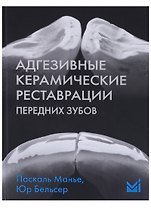 Адгезивные керамические реставрации передних зубов