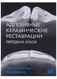Адгезивные керамические реставрации передних зубов