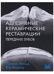 Адгезивные керамические реставрации передних зубов